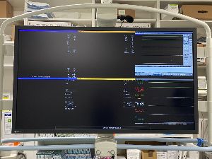 血管撮影装置のモニター画面